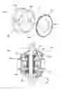 Fig. 04 - Differential gear assembly