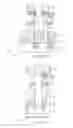 Fig. 45 - Magnetoresistive memory device