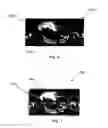 Fig. 07 - Generating and transmitting metadata for virtual reality
