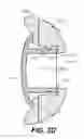 Fig. 09 - External attachments for speakers in seats