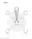 Fig. 02 - Method for signal processing in a binaural hearing device and binaural hearing device