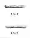 Fig. 05 - POPPED SNACK