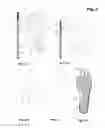 Fig. 04 - Balance-improving liquid-filled insole for use in therapeutics, rehabilitation, standing and walking work and sports