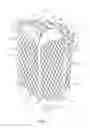 Fig. 02 - Suitcase molding process with overlay