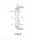 Fig. 07 - RING-SHAPED COVER FOR PORTABLE ELECTRONIC DEVICE