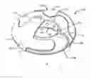 Fig. 01 - Vibratory body scrubber