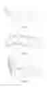 Fig. 02 - Urinary device for emergency use