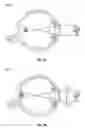 Fig. 10 - Methods and systems for diagnosing binocular vision conditions