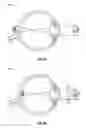Fig. 11 - Methods and systems for diagnosing binocular vision conditions