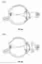 Fig. 12 - Methods and systems for diagnosing binocular vision conditions