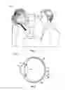 Fig. 02 - Methods and systems for diagnosing eyes using aberrometer