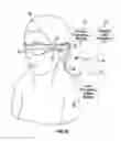 Fig. 04 - Methods and systems for diagnosing eyes using aberrometer