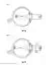 Fig. 10 - Methods and systems for diagnosing eyes using aberrometer