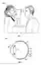 Fig. 02 - Methods and systems for detecting health conditions by imaging portions of the eye, including the fundus