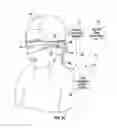 Fig. 04 - Methods and systems for detecting health conditions by imaging portions of the eye, including the fundus