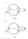 Fig. 10 - Methods and systems for detecting health conditions by imaging portions of the eye, including the fundus