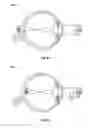Fig. 11 - Methods and systems for detecting health conditions by imaging portions of the eye, including the fundus