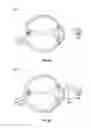 Fig. 12 - Methods and systems for detecting health conditions by imaging portions of the eye, including the fundus