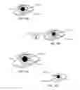 Fig. 12 - System and method for optical detection of cognitive impairment