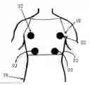 Fig. 01 - Monitoring pneumocardial function