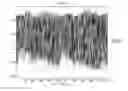 Fig. 03 - Spectral doppler imaging with interruption avoidance
