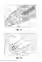 Fig. 09 - Biopsy device with aspiration valve