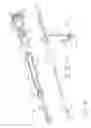 Fig. 09 - CUTTER DRIVE ASSEMBLY FOR BIOPSY DEVICE