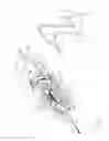 Fig. 02 - Biopsy device with integral vacuum assist and tissue sample and fluid capturing canister