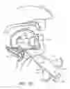 Fig. 22 - Methods for hyoid suspension
