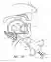 Fig. 23 - Methods for hyoid suspension