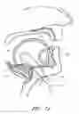 Fig. 25 - Methods for hyoid suspension