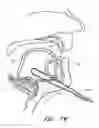 Fig. 28 - Methods for hyoid suspension