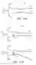 Fig. 40 - Methods for hyoid suspension
