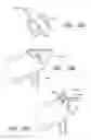 Fig. 47 - Methods for hyoid suspension