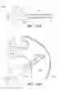 Fig. 63 - Methods for hyoid suspension