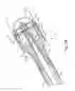 Fig. 04 - Powered surgical circular stapler with removable cartridge having threaded interface