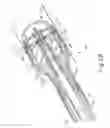 Fig. 04 - Powered surgical circular stapler with removable cartridge and pivoting anvil