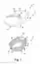 Fig. 02 - Orthopaedic surgical instrument system and method for surgically preparing a patients bone
