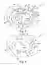 Fig. 04 - Orthopaedic surgical instrument system and method for surgically preparing a patients bone