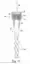 Fig. 09 - Orthopaedic surgical instrument system and method for surgically preparing a patients bone