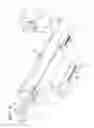 Fig. 09 - Surgical Device For Removing Tissue From Body