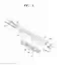 Fig. 10 - Surgical Device For Removing Tissue From Body