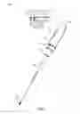 Fig. 02 - Translatable outer tube for sealing using shielded lap chole dissector