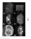 Fig. 02 - Position guidance device with bubble level