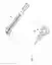 Fig. 08 - COMPRESSION IMPLANTS, INSTRUMENTS AND METHODS