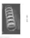 Fig. 35 - Methods and apparatuses for remodeling tissue of or adjacent to a body passage