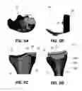 Fig. 06 - Implant placement planning