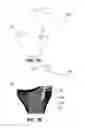 Fig. 08 - Implant placement planning