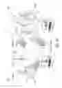 Fig. 03 - Orthognathic biomechanical simulation