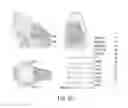 Fig. 09 - Orthognathic biomechanical simulation